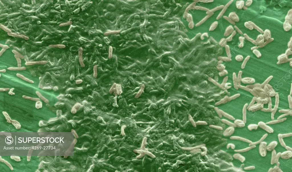 Biofilm. Color enhanced scanning electron micrograph (SEM) of a laboratory-grown potable water biofilm. Aquatic bacteria were grown as biofilm on steel for one week. Biofilms are colonies of microorganisms that attach and grow on a solid surface that has been exposed to moisture.