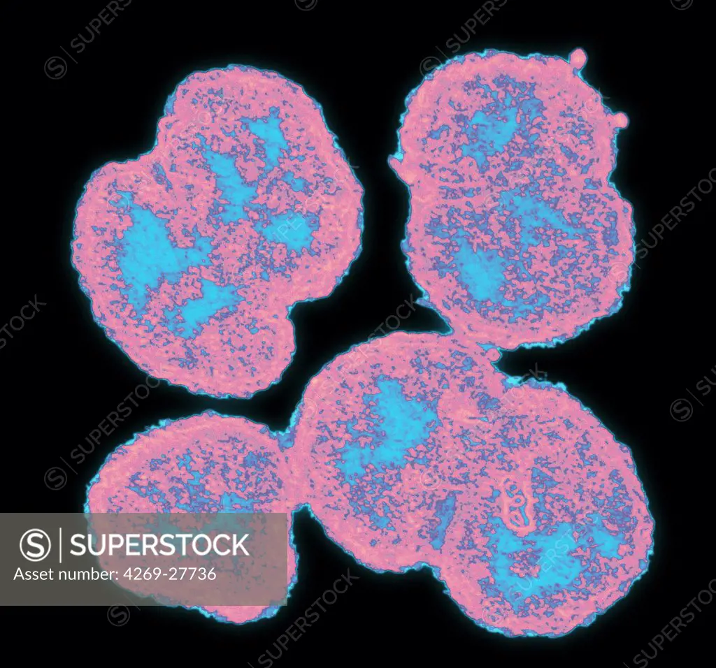 Neisseria gonorrhoeae. Color enhanced electron micrograph of Neisseria gonorrhoeae, an aerobic Gram-negative bacterium responsible for the Sexually transmitted infection Gonorrhea. Approximate mag. 100,000X.