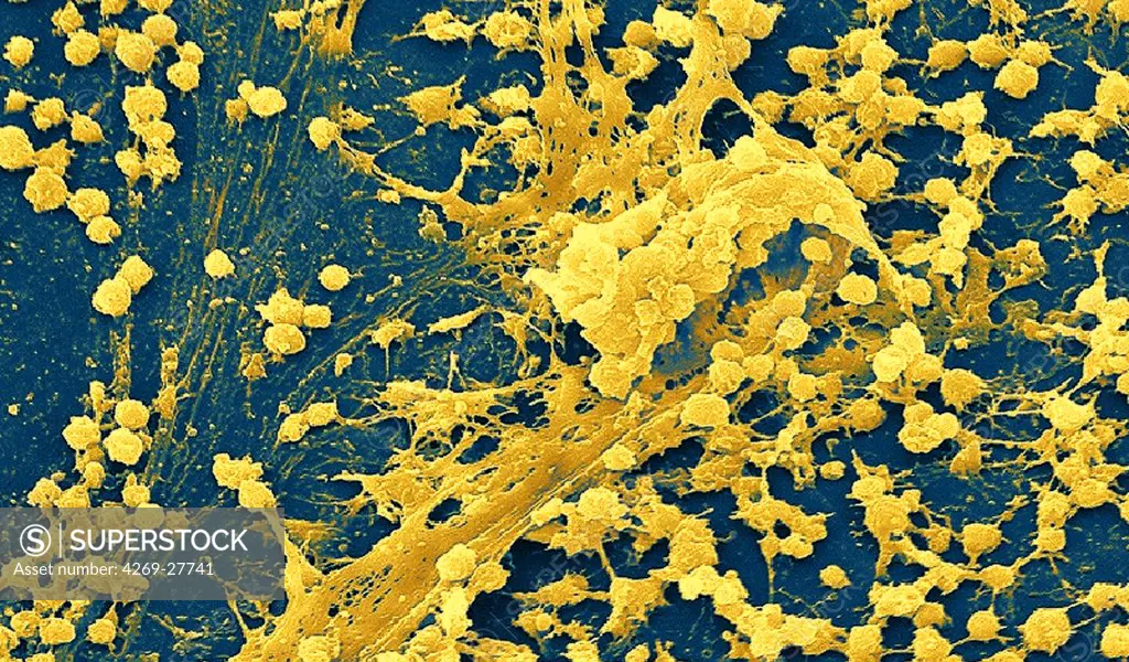 Staphylococcus. Color enhanced scanning electron micrograph of a Staphylococcus biofilm on the inner surface of a needleless connector.