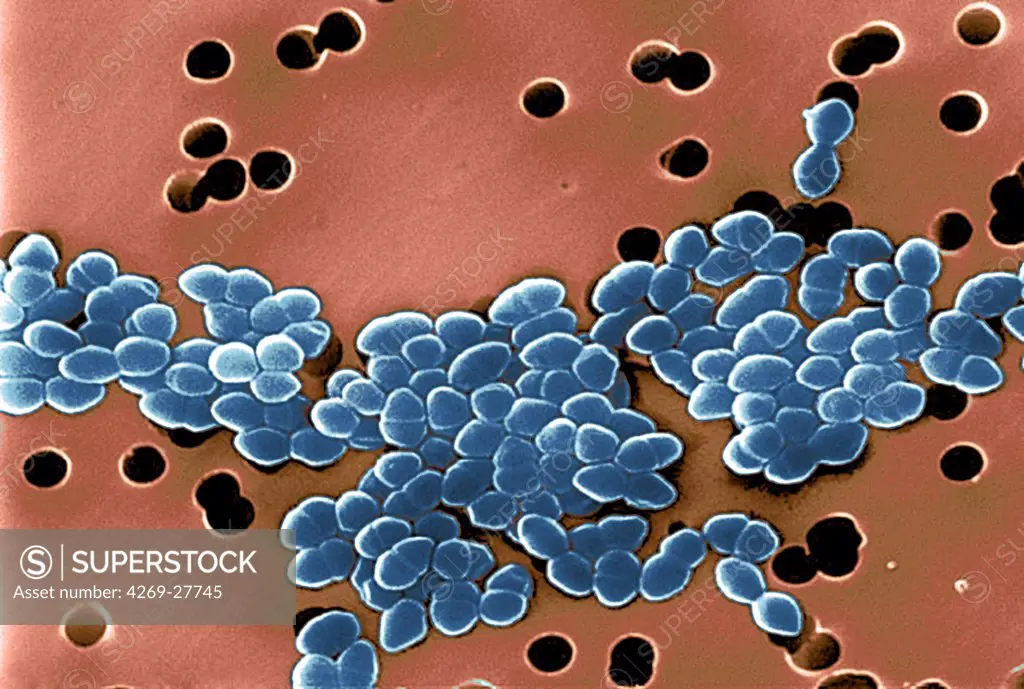 Vancomycin Resistant Enterococcus. Color enhanced scanning electron micrograph of Vancomycin Resistant Enterococci (VRE). This strain of enterococcus bacteria is resistant to the antibiotic vancomycin, known as Vancomycin Resistant Enterococci. Illness due to VRE infections in healthy people is rare. Common infections caused by enterococci are urinary tract inections and wound infections.