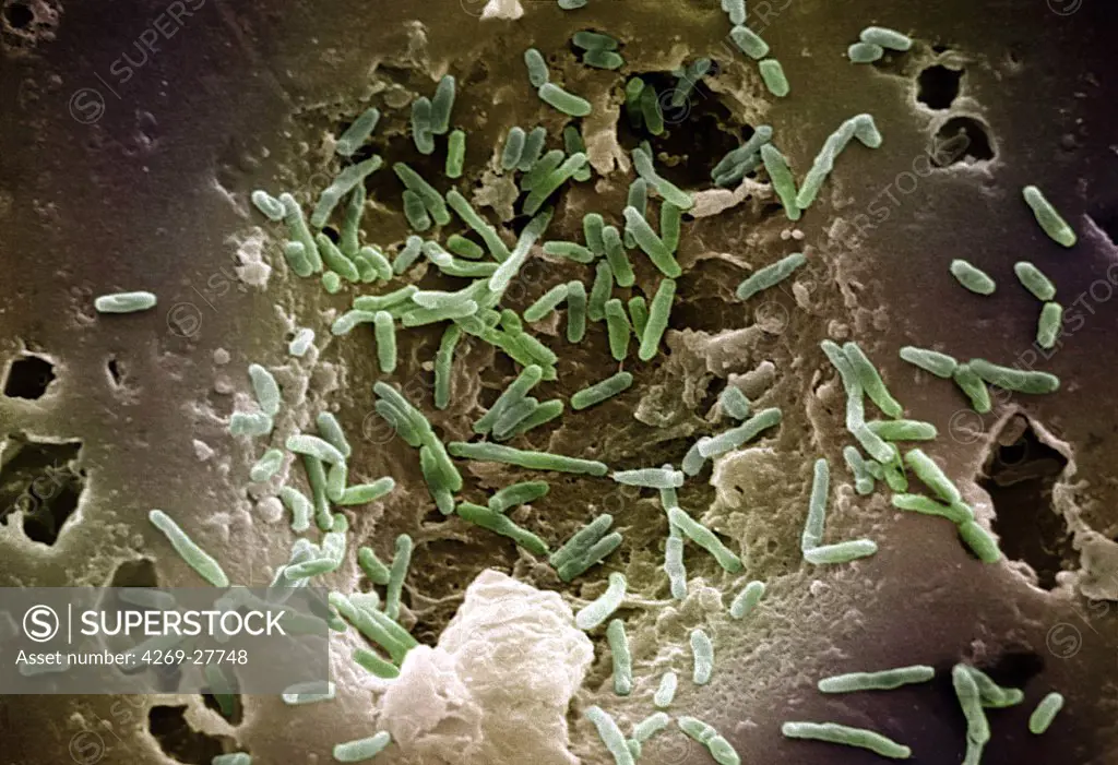 Mycobacterium chelonae. Scanning Electron Micrograph (SEM)of Mycobacterium chelonae, a bacterium causing postoperative wound infections in soft tissue and bone.