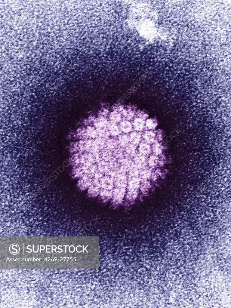 Human papilloma virus. Colored transmission electron micrograph (TEM) of human papillomavirus (HPV). The HPV is involved in the development of cervical cancers.