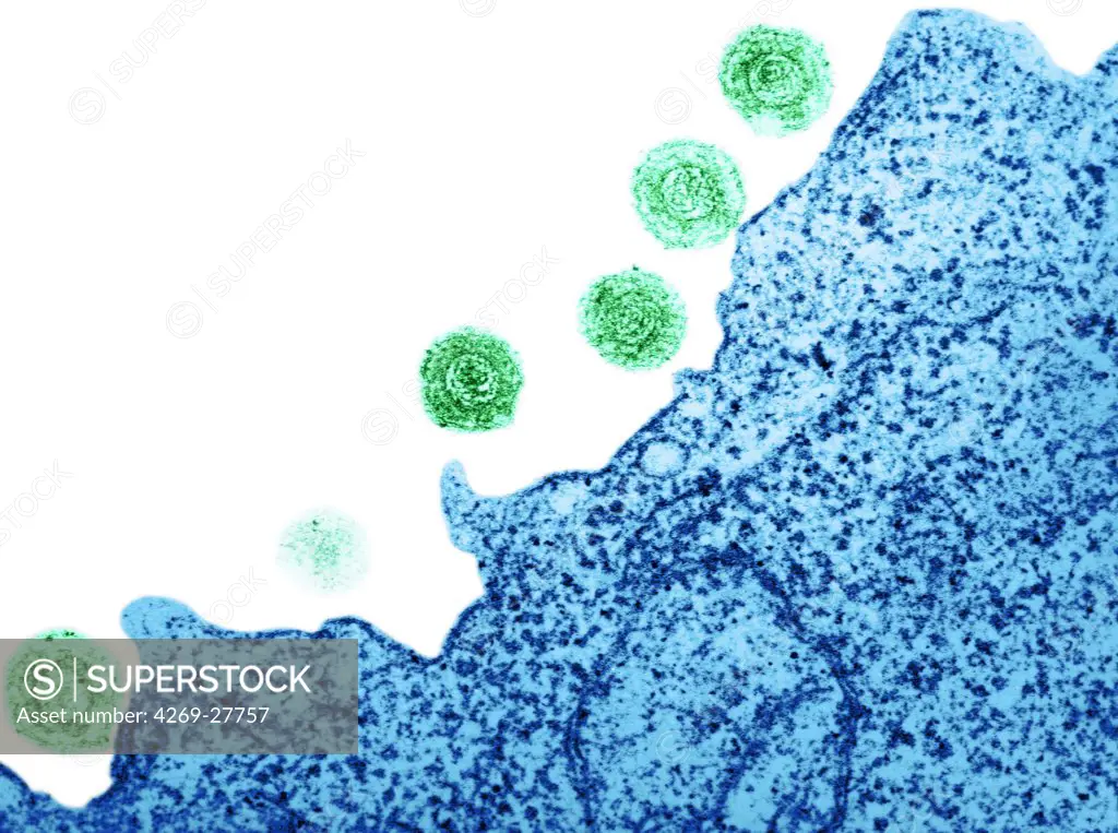 Human herpes virus-6. Transmission electron micrograph (TEM) of human herpes virus-6 (HHV-6) previously called HBLV (human b-lymphotropic virus). It infects lymphocyte T cells as well. It is the cause of the childhood rash 'roseola' and some cases of mononucleosis.