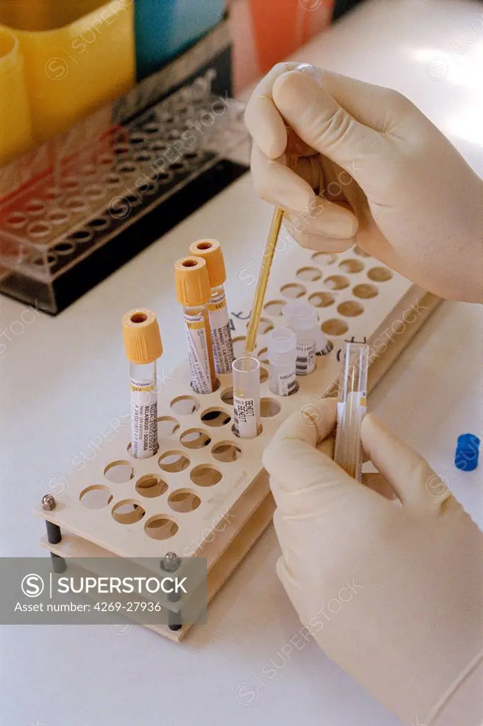 Laboratory. Technician testing blood samples of a potential organ donor for virus analysis. Virology laboratory, Henri-Mondor hospital, CrÈteil, France.