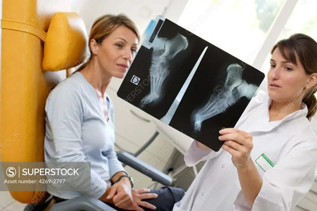 Chiropodist examining X-ray of the sole of a patient's foot before molding arch support insole.