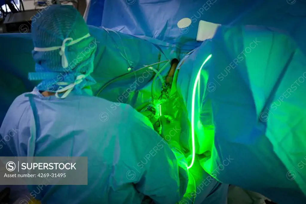 Treatment of Benign Prostatic Hyperplasia (BPH) by Photoselective Vaporization of the Prostate (PVP) using the Greenlight PV Laser System. Diaconesses hospital, Paris, France.