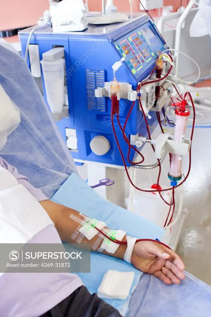 Patient hemodialysis and transfusion for anemia. Limoges hospital, France.