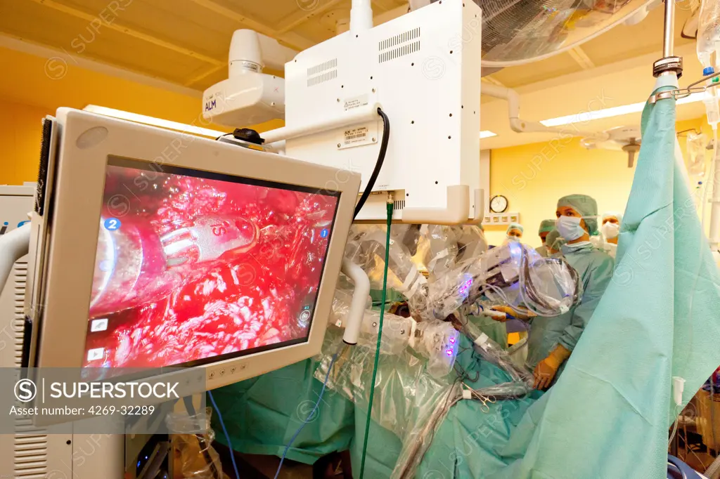 Prostatectomy performed by the telesurgery robot Da Vinci, which four articulated arms and camera are controlled at distance by a surgeon. Limoges hospital, France.