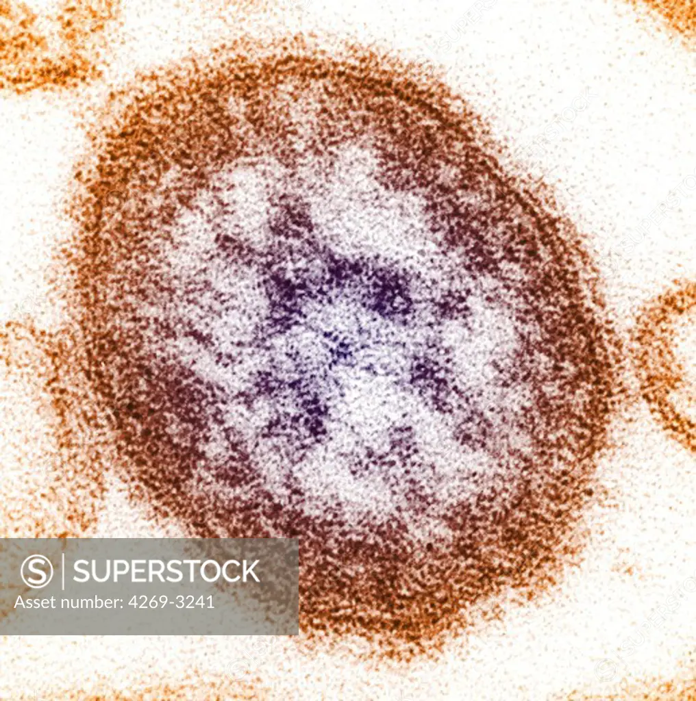 Transmission electron micrograph (TEM) of measles virus. This RNA virus is a paramyxovirus, of the genus Morbillivirus.