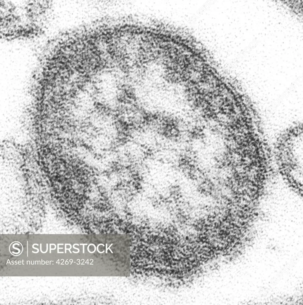 Transmission electron micrograph (TEM) of measles virus. This RNA virus is a paramyxovirus, of the genus Morbillivirus.