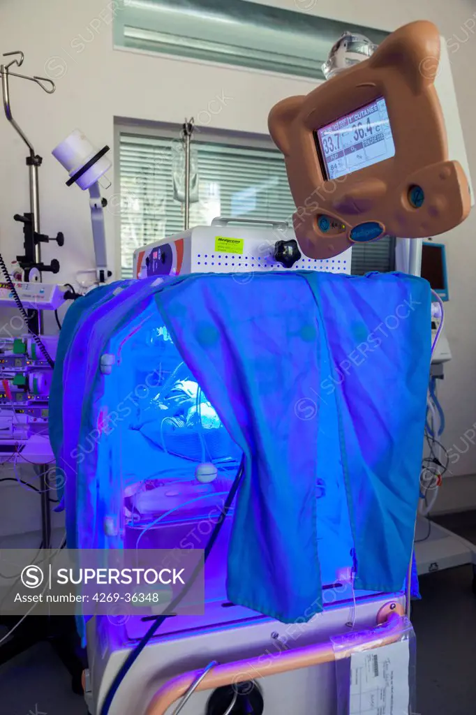 Newborn baby undergoing ultraviolet light treatment for jaundice Maternity department, Cochin hospital, Paris, France