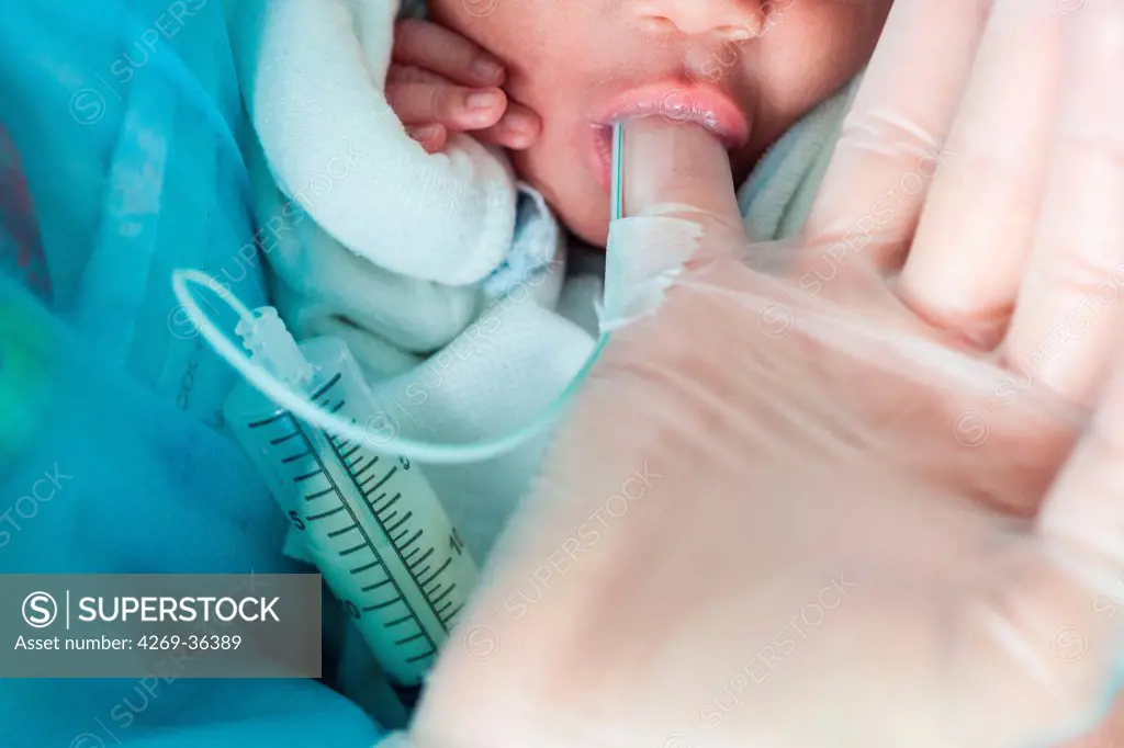 Pediatric nurse feeding a premature baby with milk