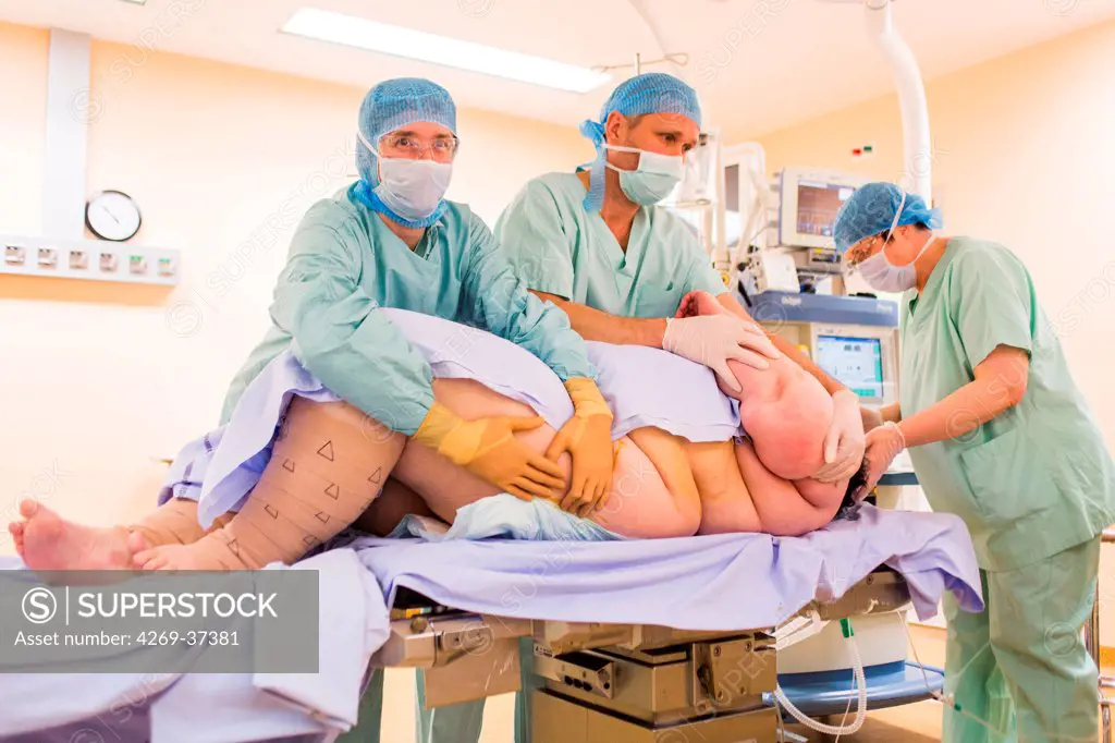 Operating theatre team holding an obese female patient at the end of a Laparoscopic Sleeve Gastrectomy, Limoges hospital.