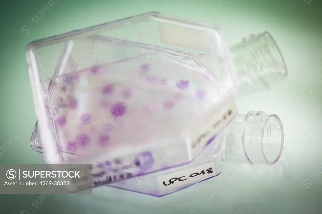 Cultures of clonogenic Mesenchymal Stem Cells (MSC), colonies of cells are stained purple.
