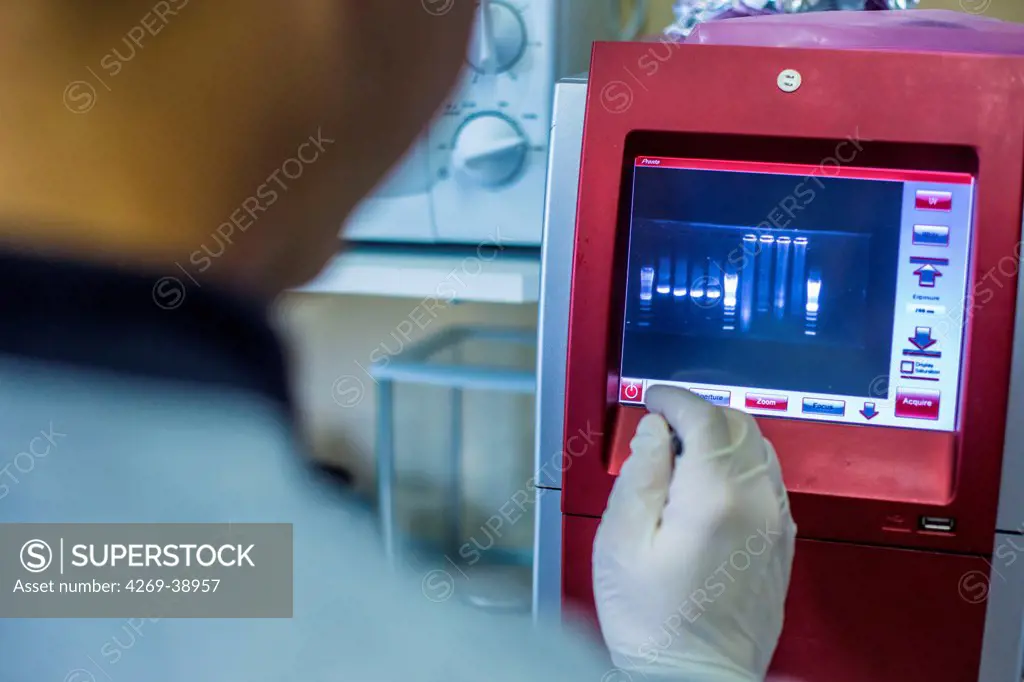 Researcher studying the banded DNA sequences of a hepatitis virus on an autoradiogram, laboratory of the Centre de Reference National des Hepatites virales, Henri Mondor Hospital, Creteil, France.