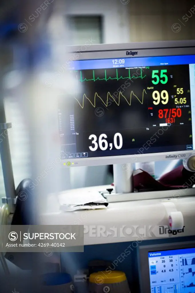 Monitoring during surgery, the vital signs (heart rate, temperature, blood pressure, blood oxygenation) of the patient are displayed on a control monitor.
