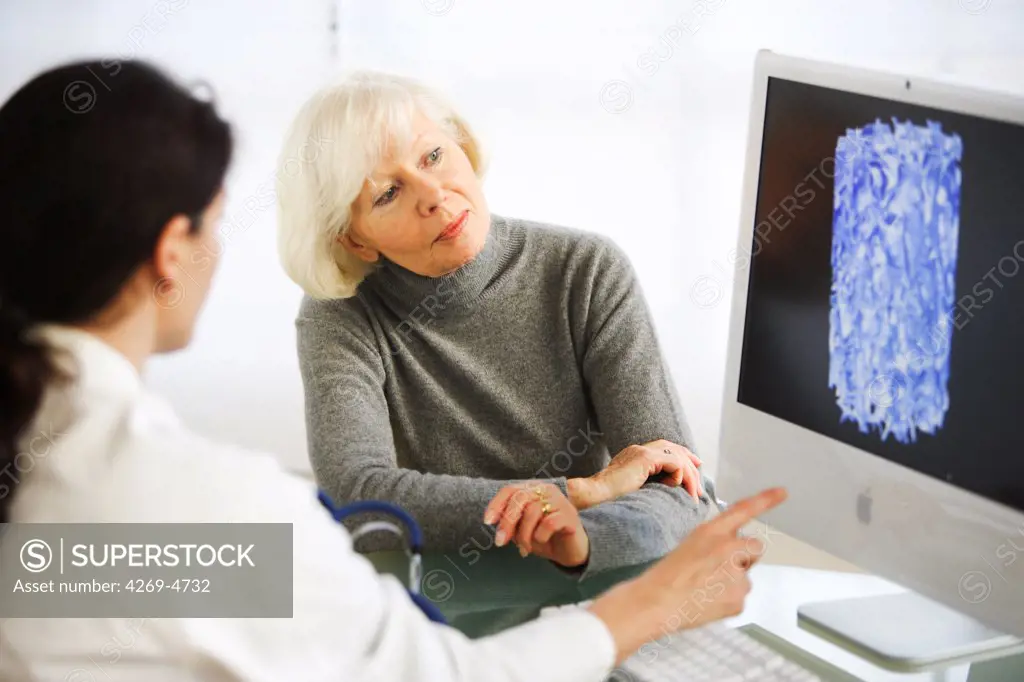 Doctor showing a patient the effect of osteoporosis on the bone structure of a vertebra.