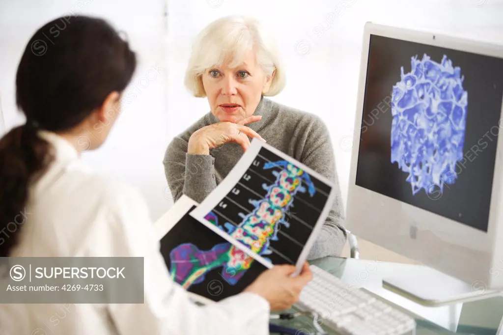 Doctor showing a patient the effect of osteoporosis.