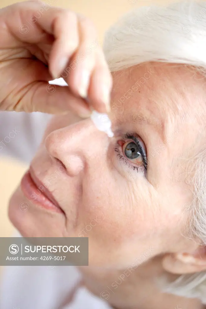 Woman applying eye-drops into her eye.