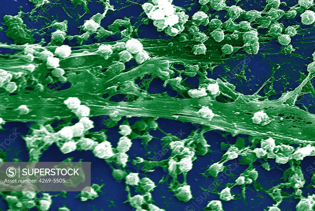 Electron micrograph (SEM) of methicillin-resistant Staphylococcus aureus bacteria (MRSA); Magnification 2363x. This strain of Gram-positif bacterium has developed wide-ranging antibiotic resistance such as methicillin, and are hospital pathogens.