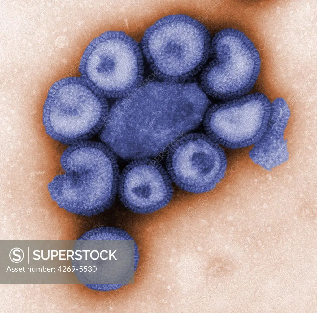 Transmission Electron Micrograph (TEM) of influenza virus particles. Influenza virus are RNA virus (Orthomyxovirus) including Influenza A and B, the two types of influenza viruses.