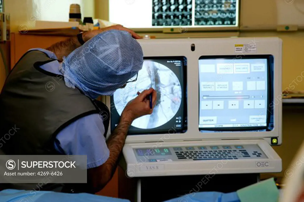 Department of vascular surgery, Pitié-Salpêtrière hospital, Paris, France. Surgery performed by Pr Fabien Koskas to treat aortic lesions ( aneurysm, dissecting aneurysm ) with custom-made endovascular implants. Here, interventional radiology monitors.