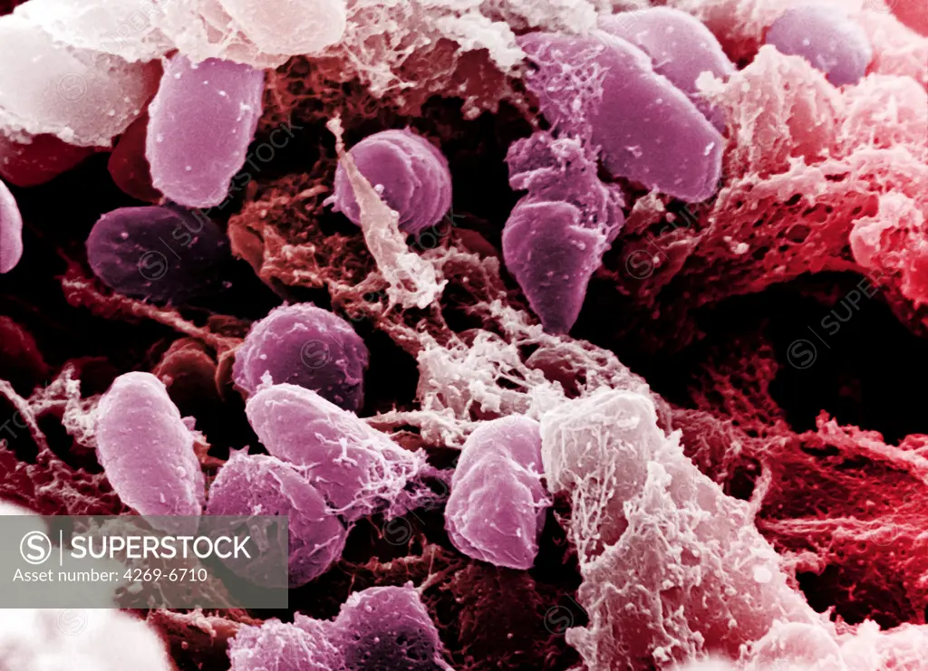 Scanning electron micrograph (SEM) depicting a mass of Yersinia pestis bacteria (the cause of bubonic plague) in the foregut of the flea vector.