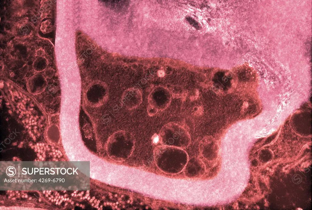 Transmission electron micrograph (TEM) of a section of axone. It is protected by a layer of myelin around.