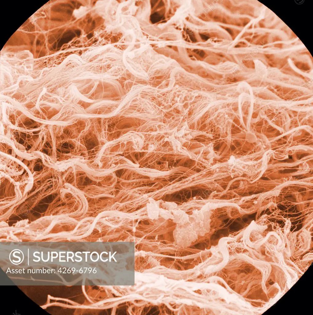 Scanning electron micrograph (SEM) of collagene fibers. Magnification x1000.