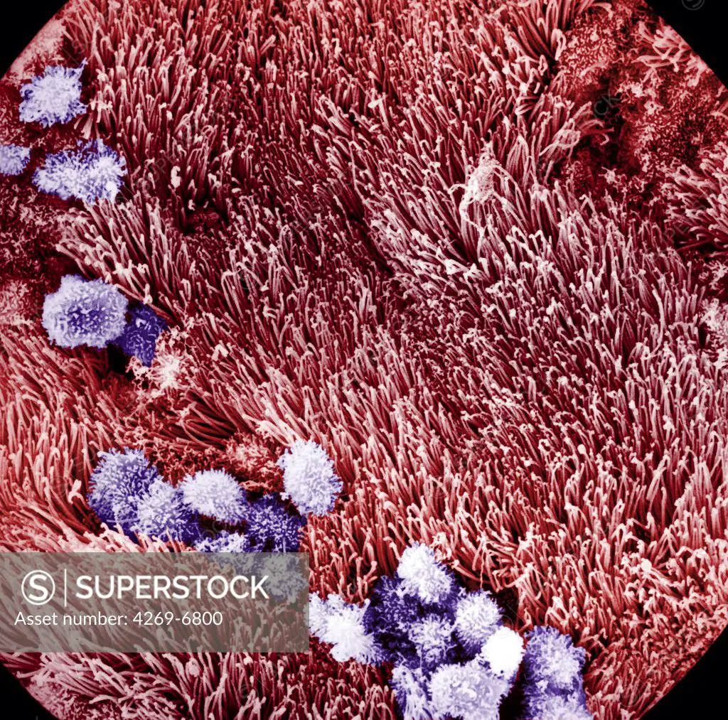 Scanning electron micrograph (SEM) of the cilia lining up the Fallopian tubes.