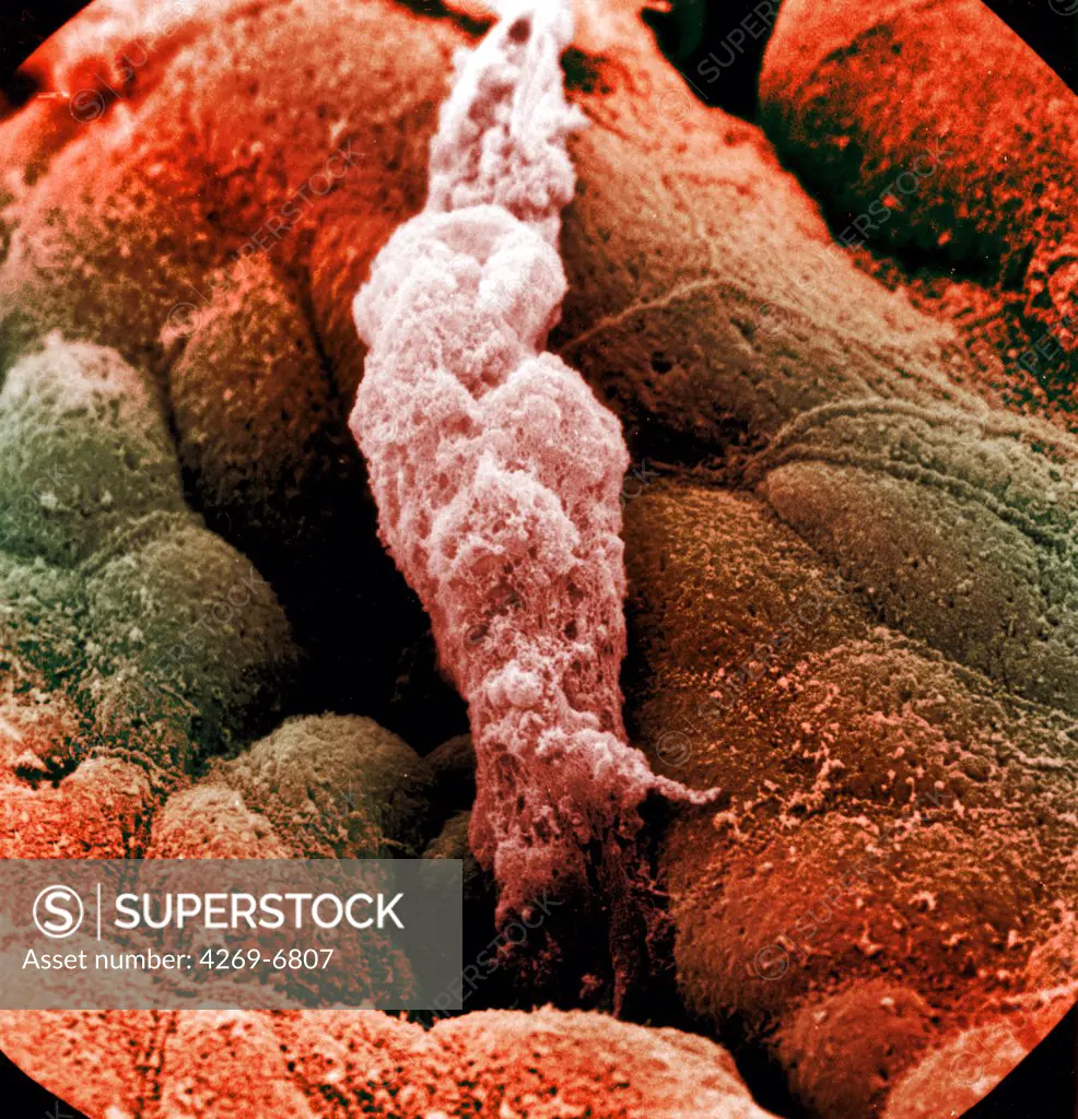 Scanning electron micrograph (SEM) of stomach wall lined with mucus producing epithelial cells. At center, a drop of secretion from a fundus gland. Maginification 3000x.
