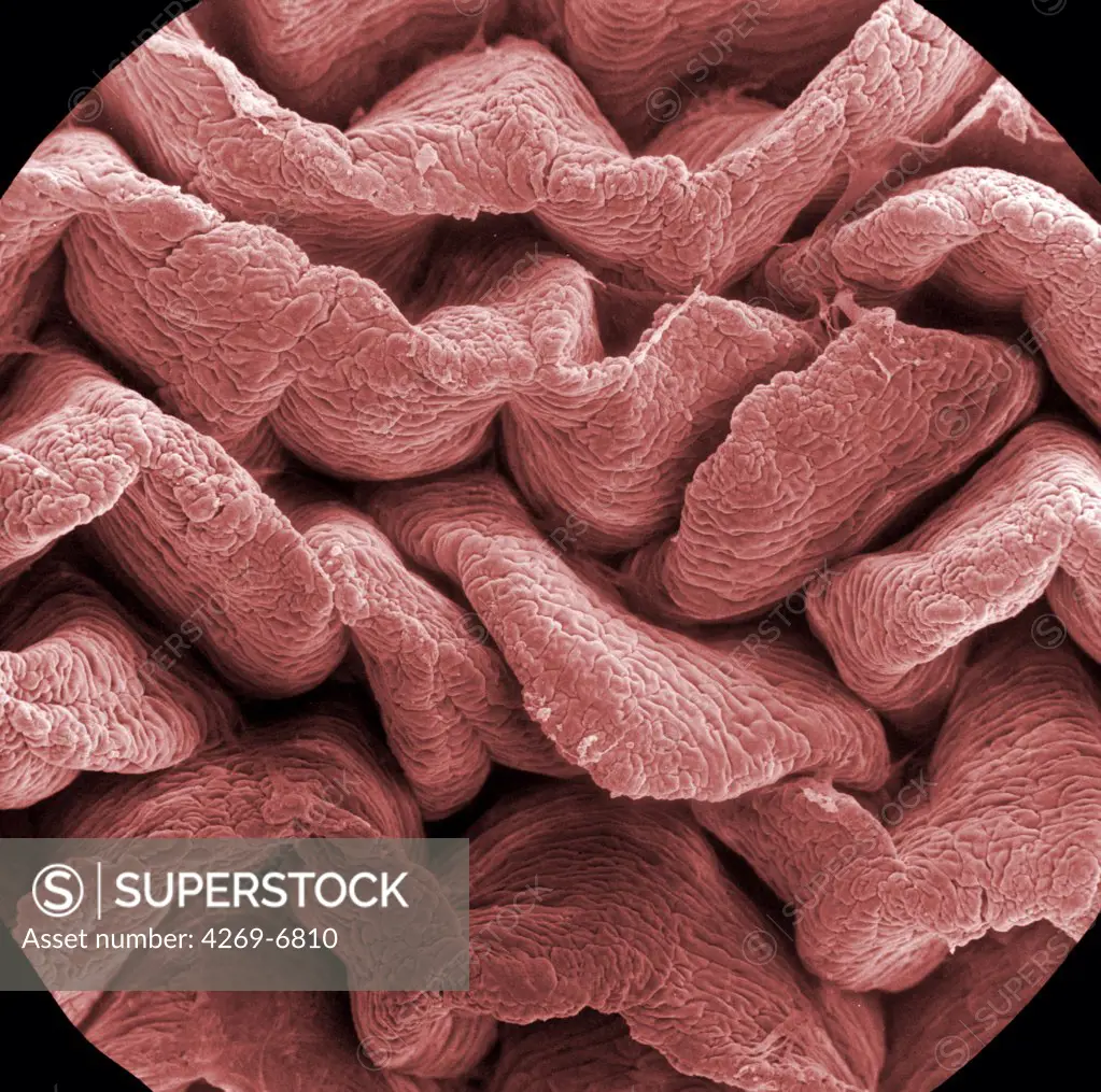 Scanning electron micrograph (SEM) of an absorptive epithelial cells lining the surface of the small intestine, showing numerous microvilli. Magnification x20000.