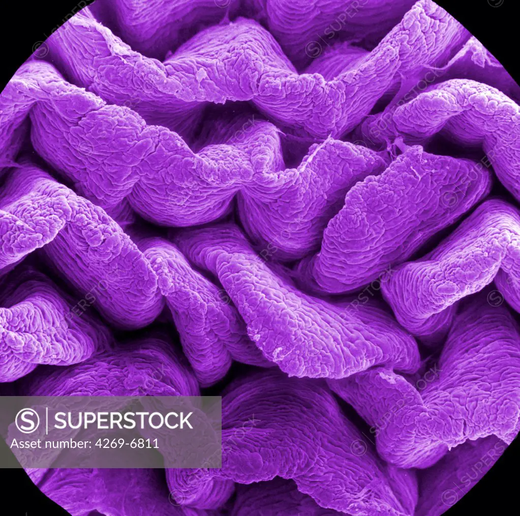 Scanning electron micrograph (SEM) of an absorptive epithelial cells lining the surface of the small intestine, showing numerous microvilli. Magnification x20000.