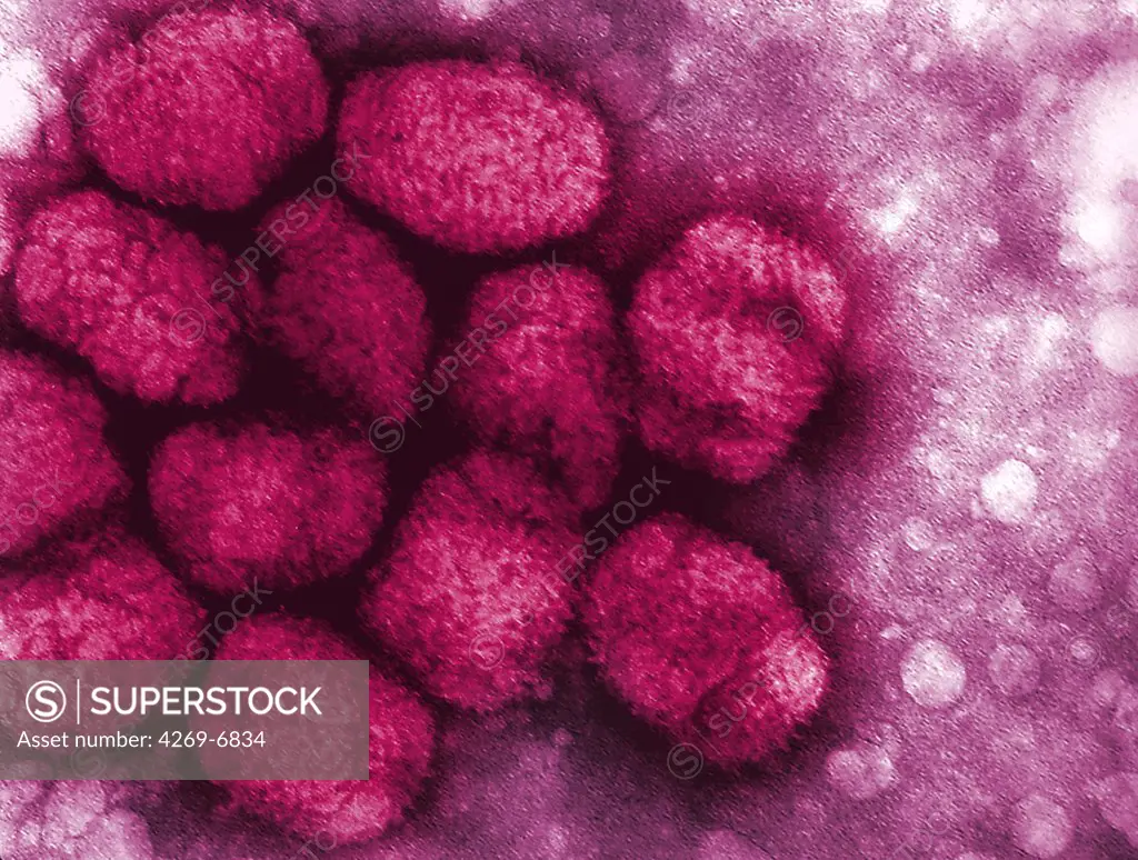 Transmission Electron Micrograph (TEM) of smallpox viruses.