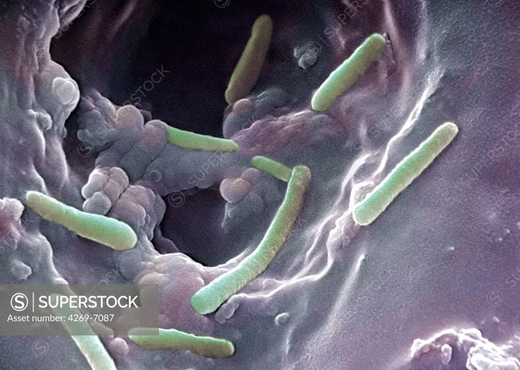Scanning Electron Micrograph (SEM) of Pseudomonas aeruginosa bacteria, also known as Bacillus pyocyaneus. This Gram-negative bacterium is responsible for wounds and urinary tract infections. It is often associated with nosocomial diseases due to its resistance to many antibiotics.