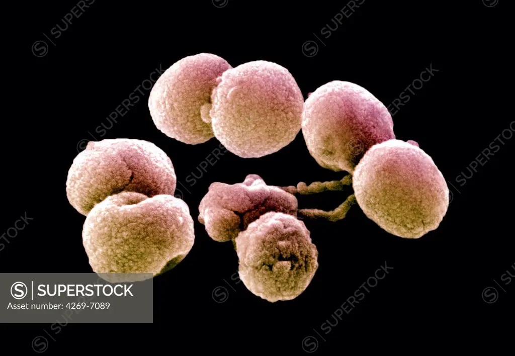 Scanning Electron Micrograph (SEM) of Streptococcus pneumoniae bacteria. This Gram-negative bacterium is a leading cause of pneumonia. It also causes many other pathologies like middle ear infections (otitis media), bacteremia and meningitis.