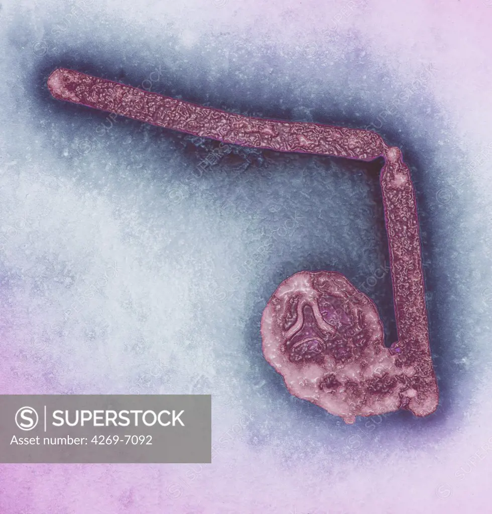 Transmission electron micrograph (TEM) of two avian influenza A H5N1 viruses. Magnification x 108,000.