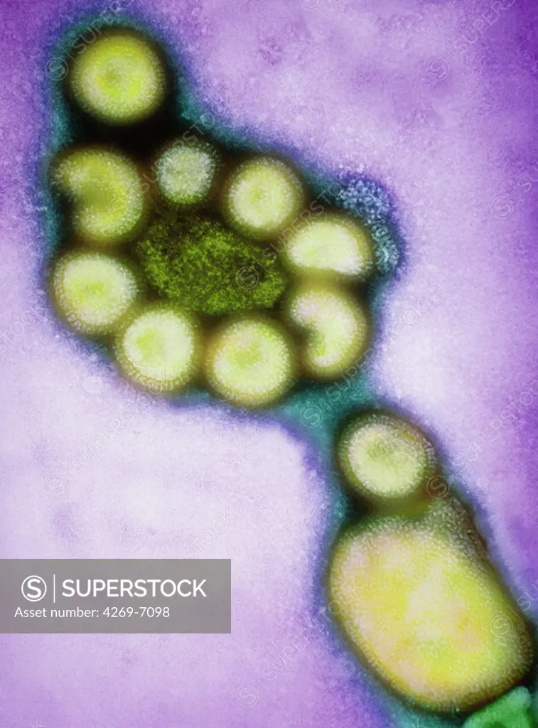 Colored transmission electron micrograph (TEM) of Hong Kong influenza (flu) viruses. Between 1968 and 1970, this pandemic flu killed 800 000 persons. The Hong Kong influenza virus is an Influenza type A virus, strain H3N2. It is very close from the Spanish or swine flu (strain H1N1) or avian flu (strain H5N1). Magnification: x54,000 at 6x4,50cm size. x30,000 at 35mm.