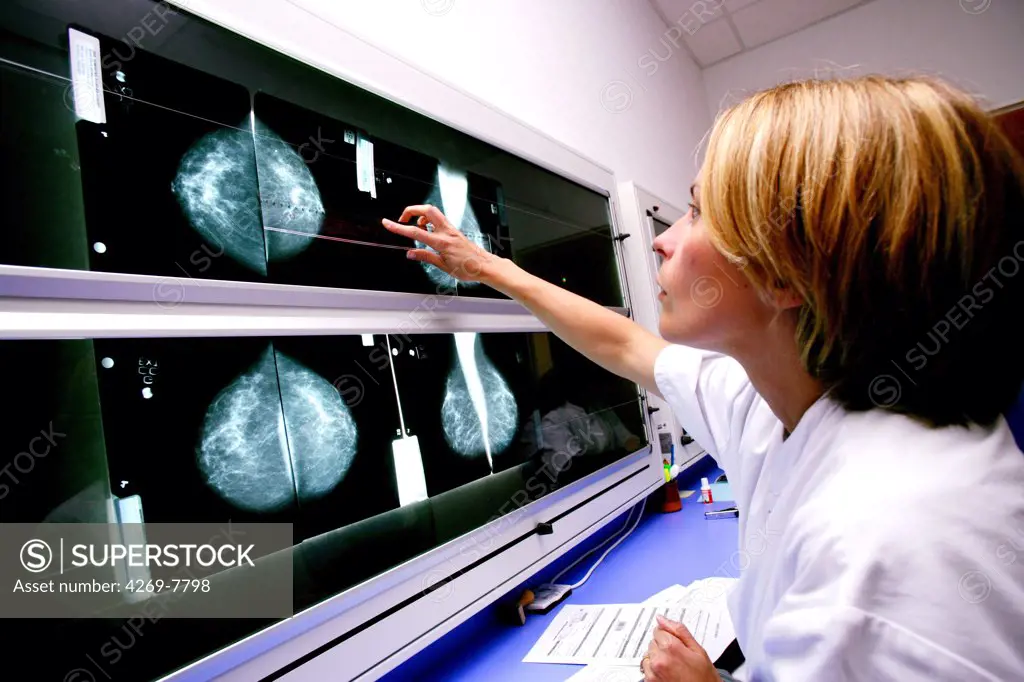 Breast cancer screening : a radiologist examines mammograms on a lightbox.