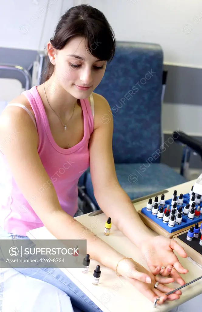 Young woman undergoing skin prick test for pneumoallergens screening. Respiratory diseases department, Limoges hospital, France.