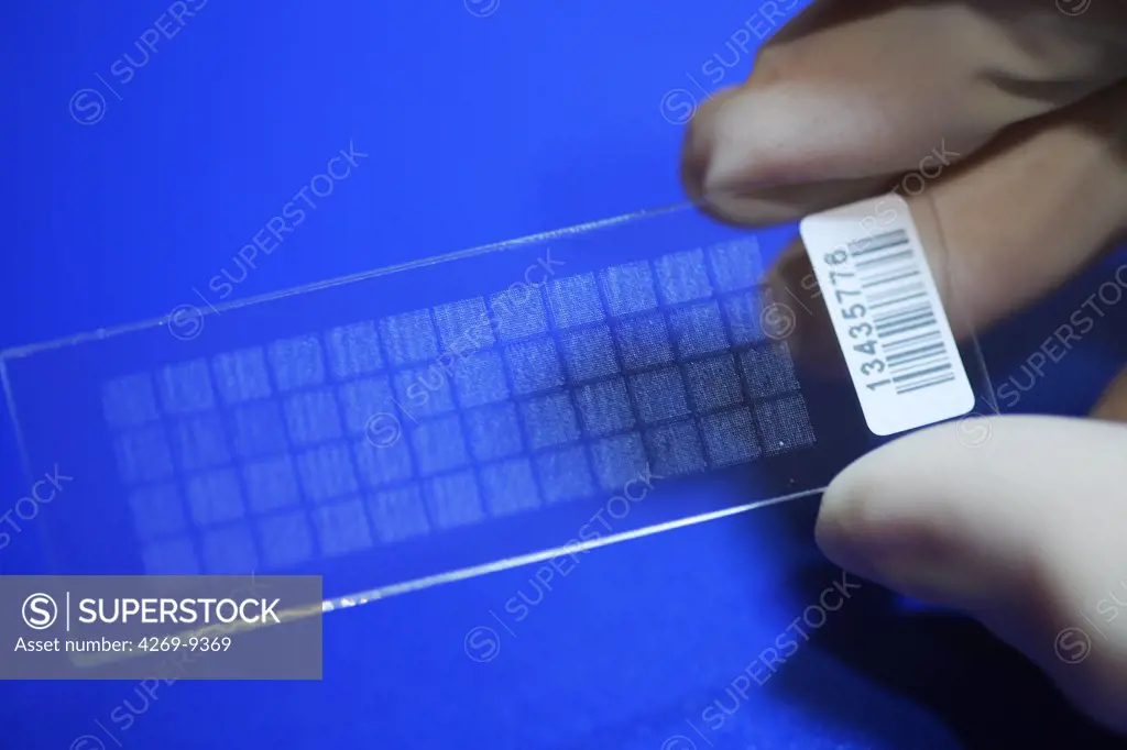 DNA chip containing the genome of an obese person. Research team of Pr Katrine Clément on nutrition and health, INSERM U872, Cordeliers Research Center, Hotel-Dieu hospital, Paris, France.
