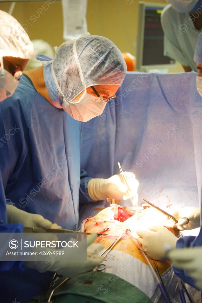 Surgeon performing mitral valve replacement surgery, an open heart surgery requiring a cardiopulmonary bypass. Thoracic and Cardiovascular Surgery Department, Limoges hospital, France.
