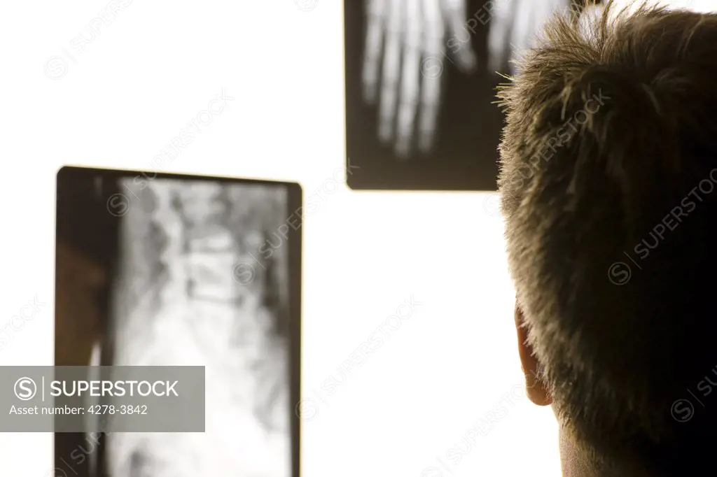 Back view of a healthcare professional head looking at x-ray