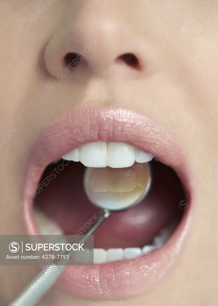 Close up of Woman's Mouth during Dental Examination