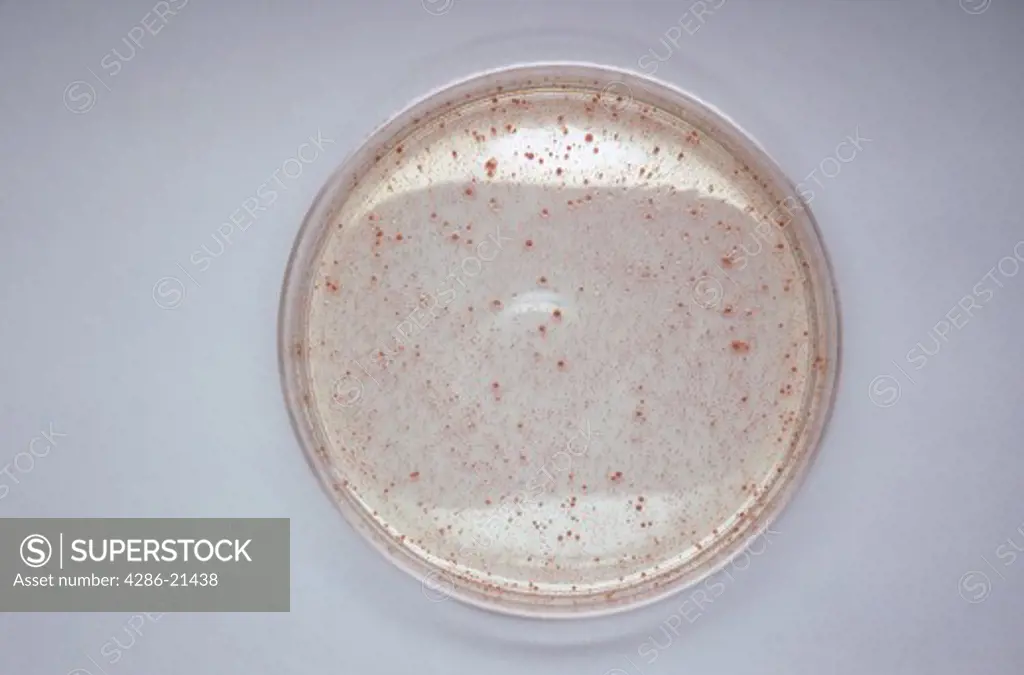 Series of dilutions of bacteria growing on nutrient Agar