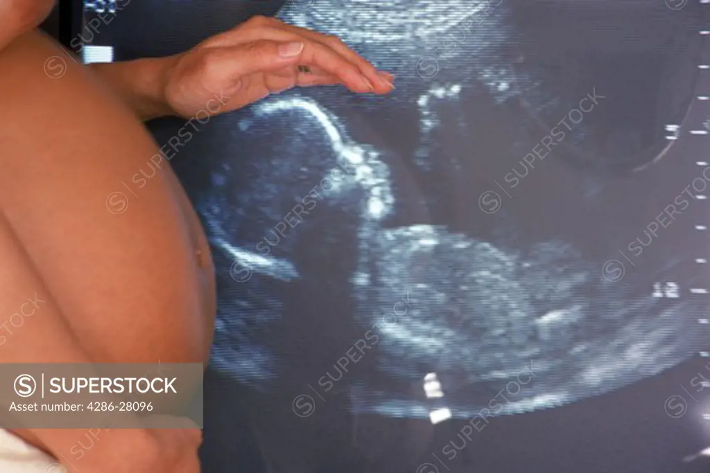 Pregnant mother with hand over head of her silhouetted fetus on ultrasound video