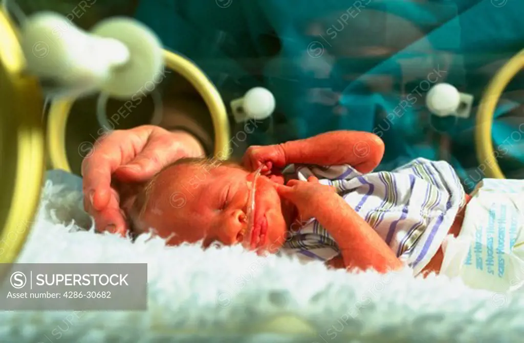 Premature infant is cared for in hospital neo-natal intensive care unit (NICU).