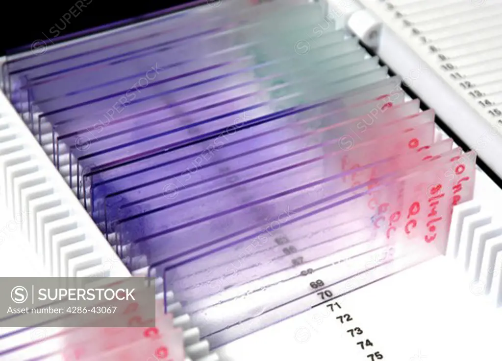 Glass microscope slides lie neatly arranged in a holder.