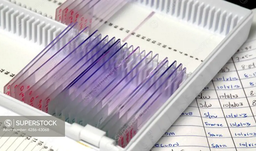 Glass microscope slides lie neatly arranged in a holder which lies atop a page of records.