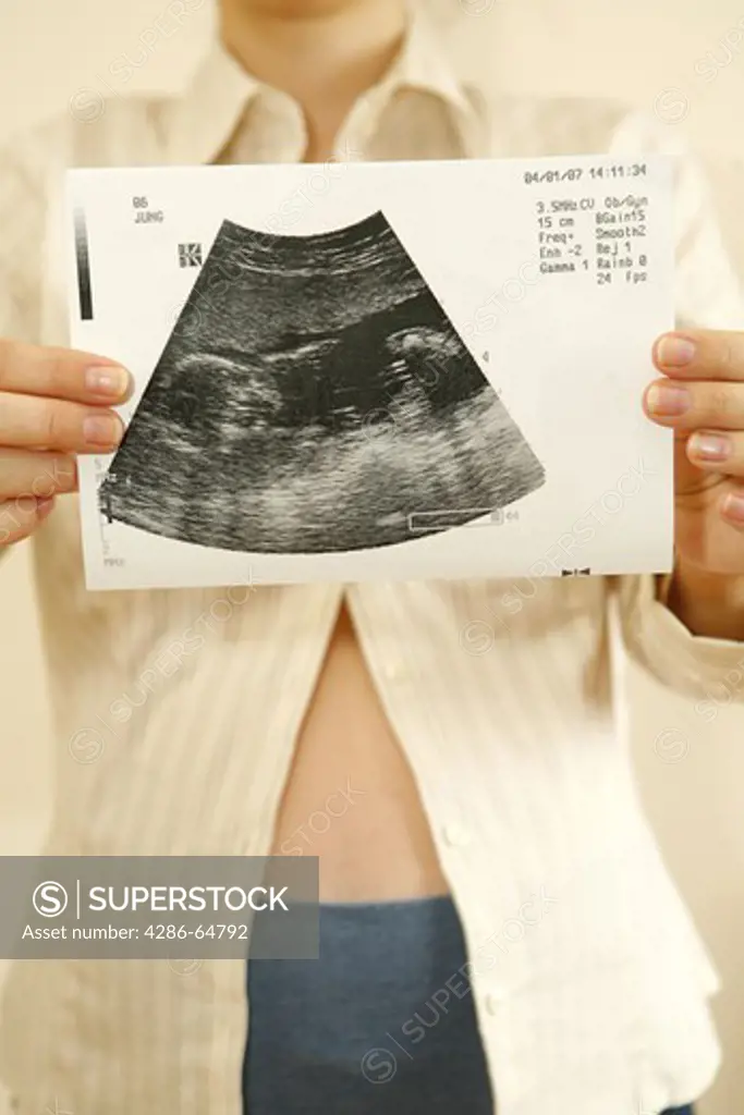 An ultrasound picture, Pregnant woman shows sonography picture shows pregnant woman